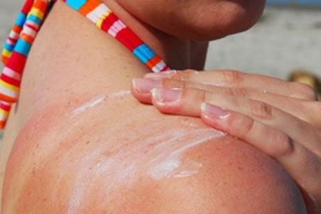 Co oznacza, że ​​oparzenie słoneczne jest lepsze - sekrety pięknej i zdrowej skóry