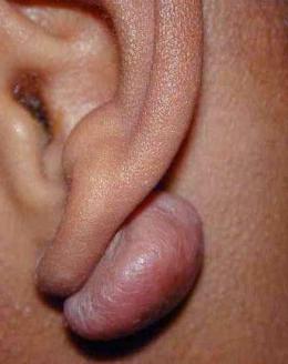 to guzek za uchem